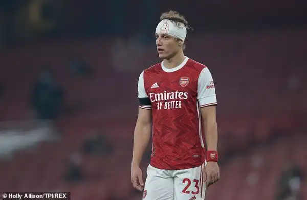 David Luiz To Miss Arsenal’s Europa League Match After Head Injury