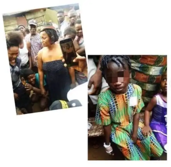 TOO BAD! Woman Allegedly Chops Off Her Niece’s Finger In Onitsha