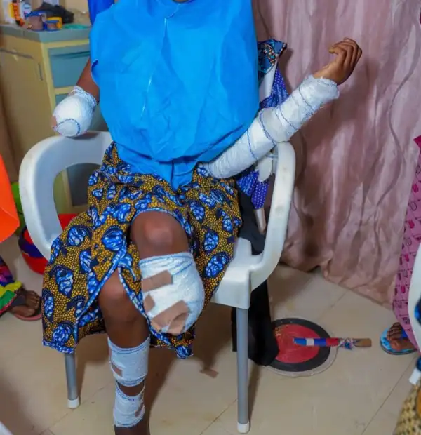 17 Year Old Girl Forced Into Marriage Loses Her Hand And Leg After Her Husband Attacked Her With a Machete in Kebbi (Photos)