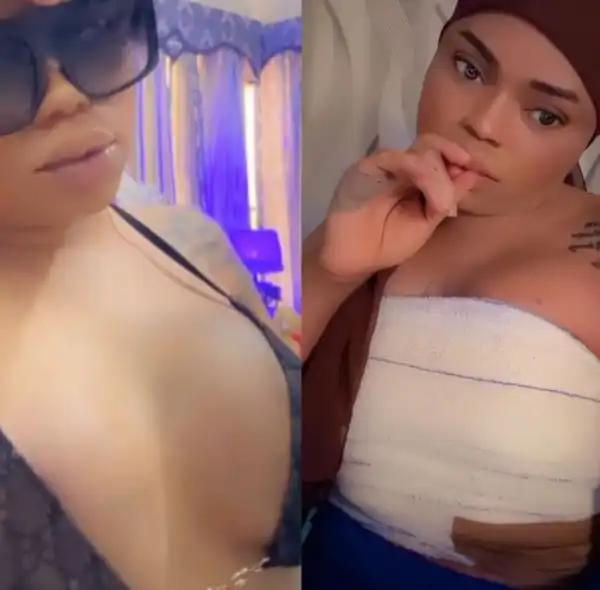 Crossdresser, Bobrisky Shows Off The Result Of His New Bre*st Surgery