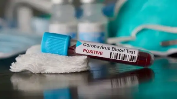Nigeria records 14 new cases of coronavirus — toll hits 111