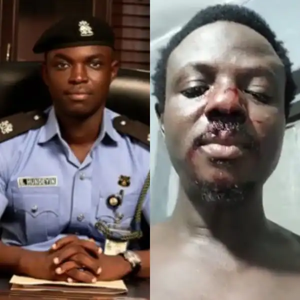 Man Abducted And Almost Killed After Boarding A Bus At Lekki-Ikoyi Roundabout Shares Experience, Police React (Video)