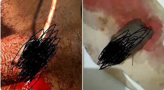 GRAPHIC!! – Pregnant woman chops off husband’s penis