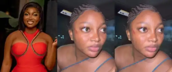 Lagos Police Speak Out After Papaya Ex Alleges Ass@ult