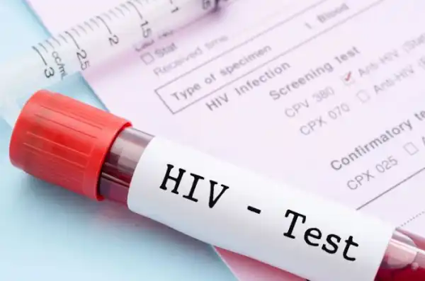 Wicked World! Doctor Allegedly Poisons Colleague’s Water With Hiv Blood