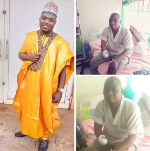 Father Of Two Narrates How Phone Snatchers Chopped Off His Hand In Kaduna (Photos)