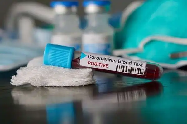 COVID-19: Nigeria Records 340 New Cases On August 21