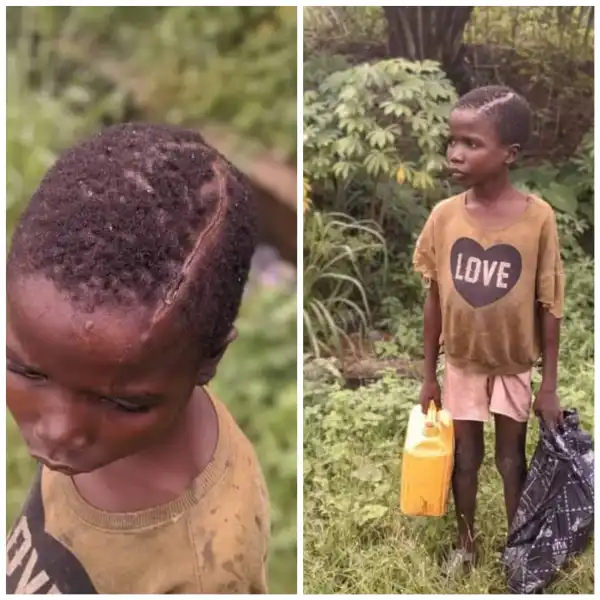 Man Attacks His Young Son With Machete Over Witchcraft Allegation in Akwa Ibom (Photo)