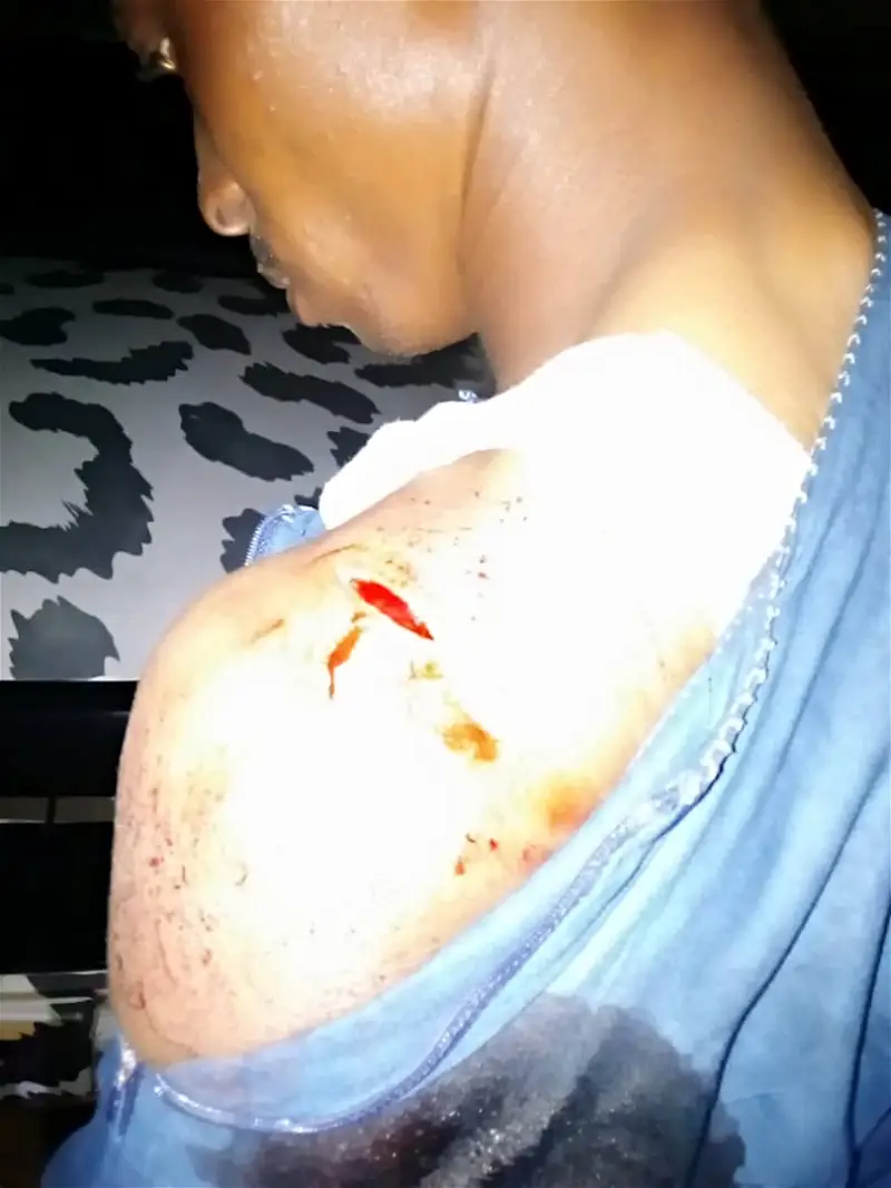 Scores injured as APC, PDP clash in Oyo
