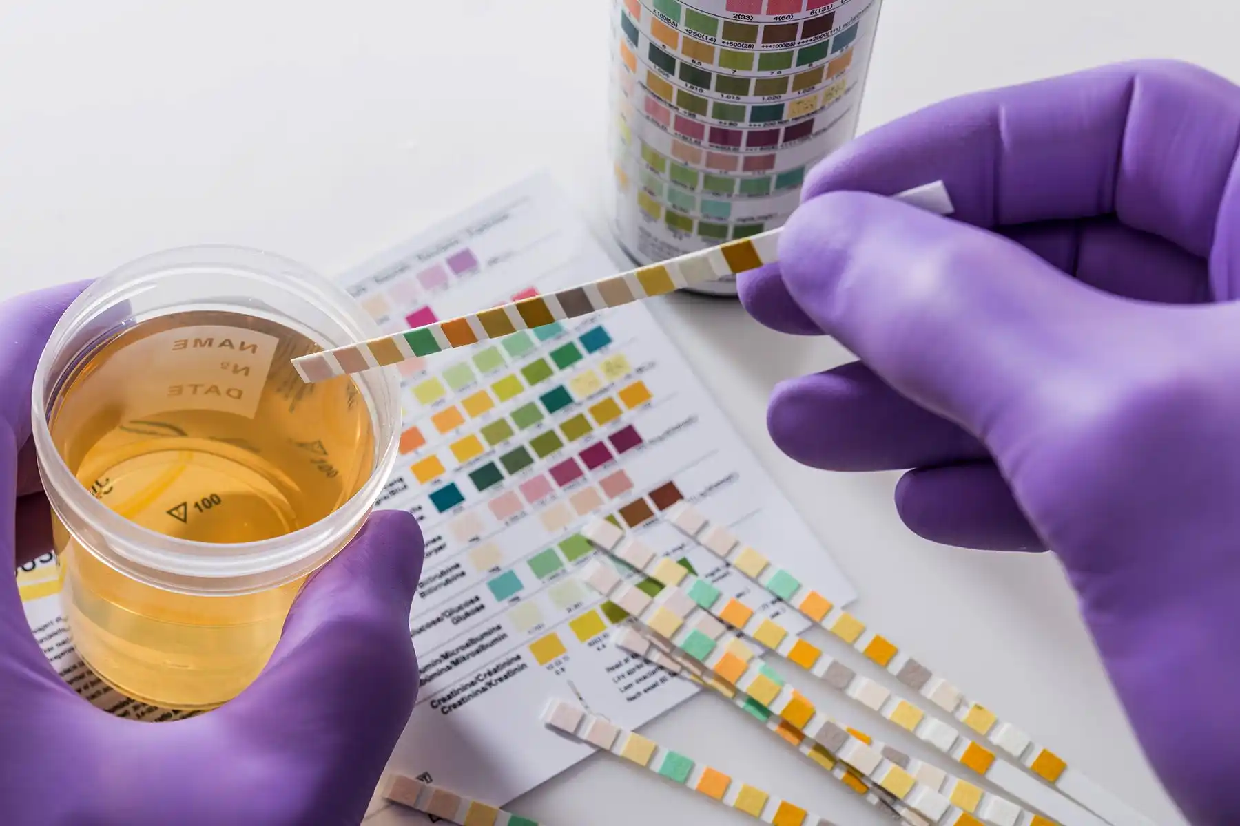 NDLEA asks political parties to make drug test mandatory for elective office hopefuls