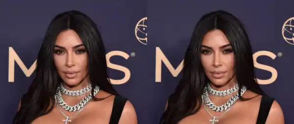 Kim Kardashian Diagnosed With Brain Problem