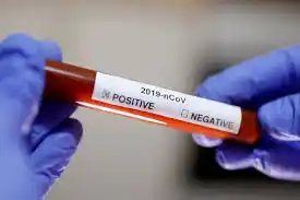 Woman allegedly slumps and dies after hearing her husband tested positive for COVID-19 in Delta