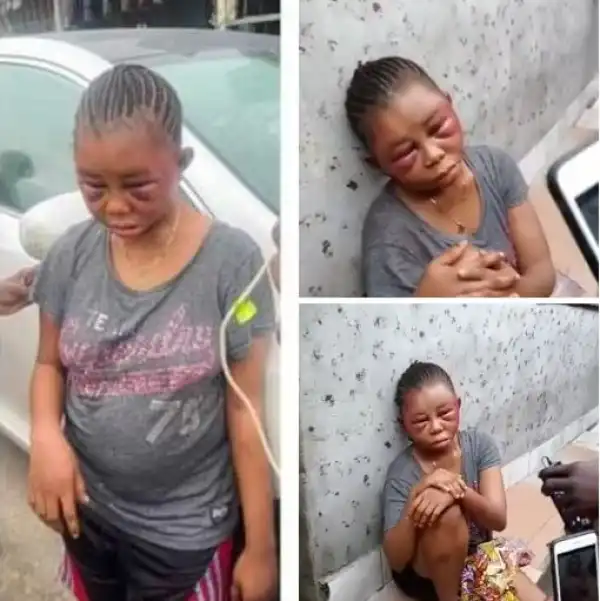 19-year-old Girl Mercilessly Beaten By Her Boyfriend In Delta State